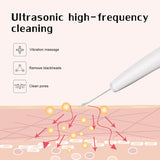 Ultrasonic Skin Scrubber – Deep Pore Cleansing & Exfoliating Spatula